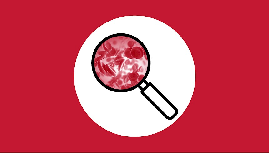 Essential Thrombocythaemia