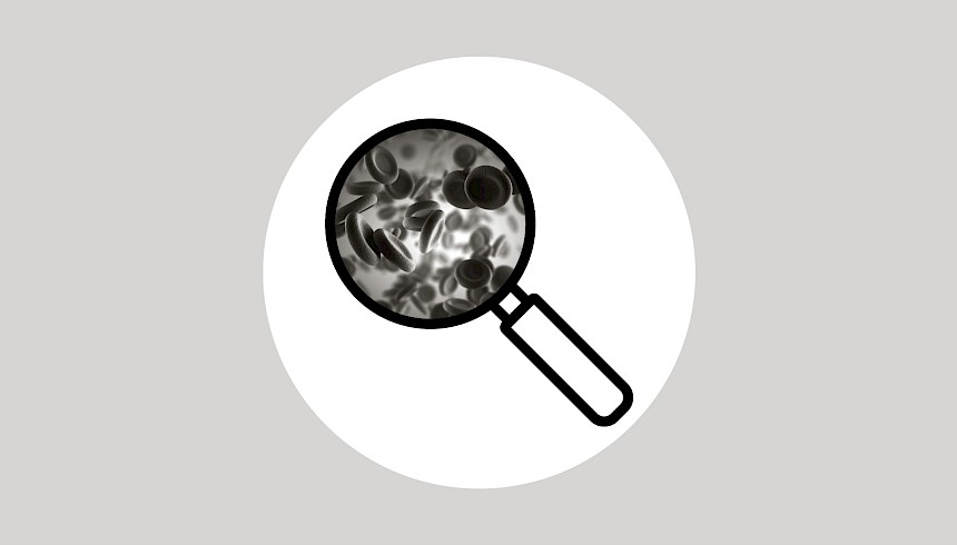 Primary Myelofibrosis