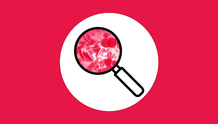Chronic myeloid leukaemia
