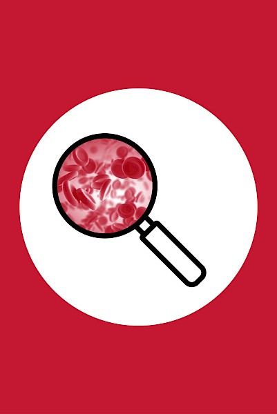 Essential Thrombocythaemia