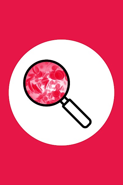 Chronic myeloid leukaemia
